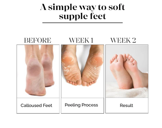 Exfoliating Foot Mask