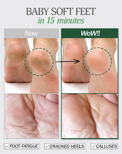 Exfoliating Foot Mask
